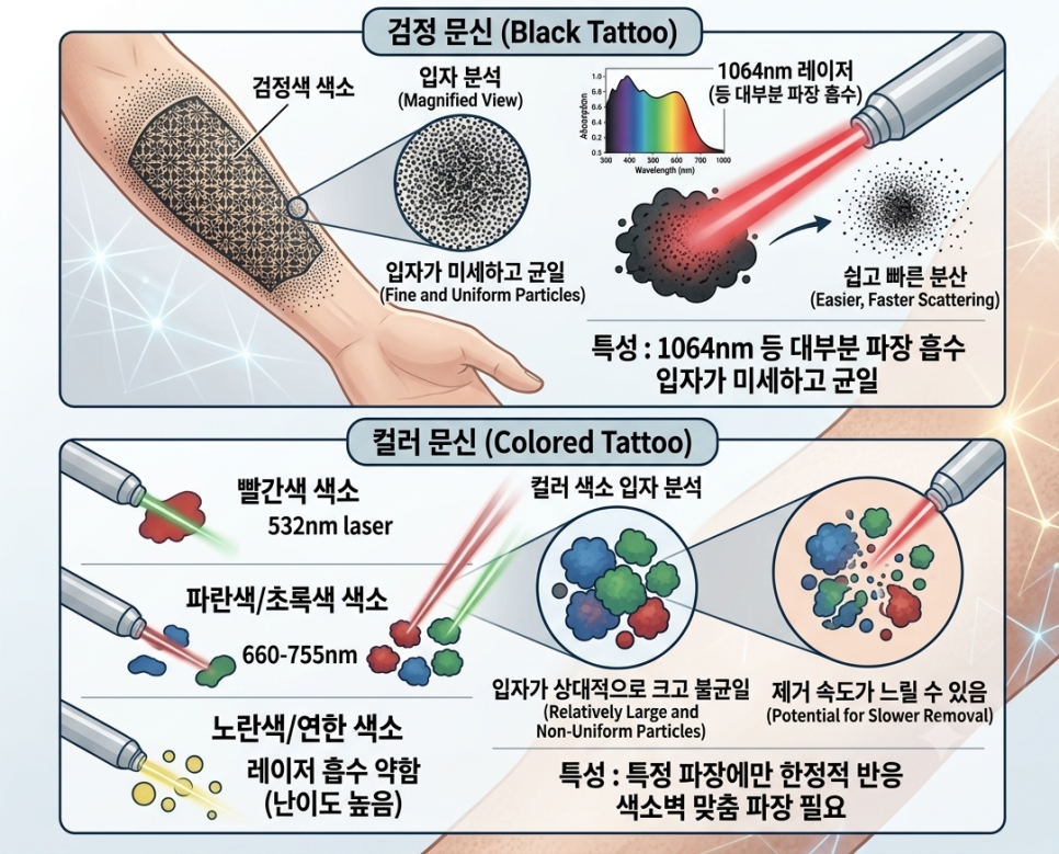 Why Colored Tattoos Are More Difficult to Remove Than Black Tattoos image 1