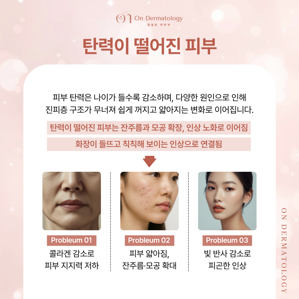Accurate and Safe with Dermashine: What Are the Effects of Juvelook and Skin Botox at Jamsil Dermatology? image 2