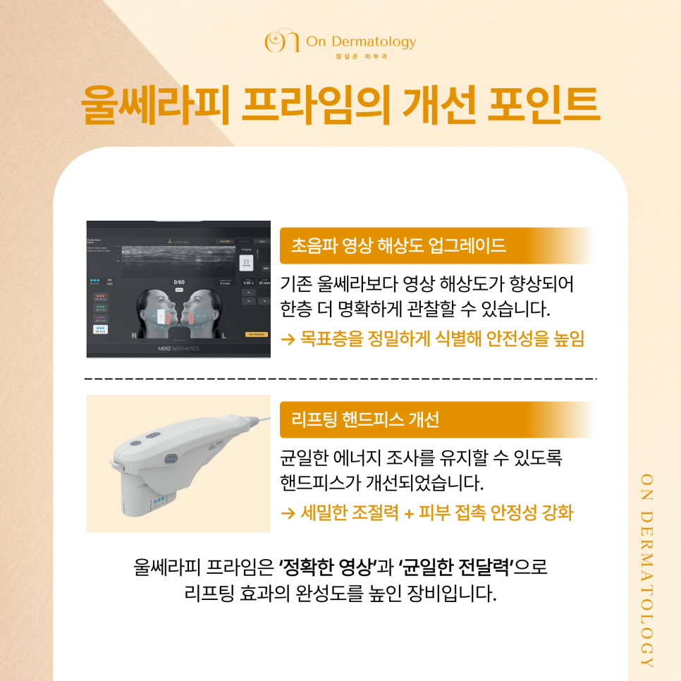 잠실역 피부과 울쎄라피 프라임, 기존 울쎄라와 뭐가 다를까? 써마지FLX와의 차이? 관련 이미지 3
