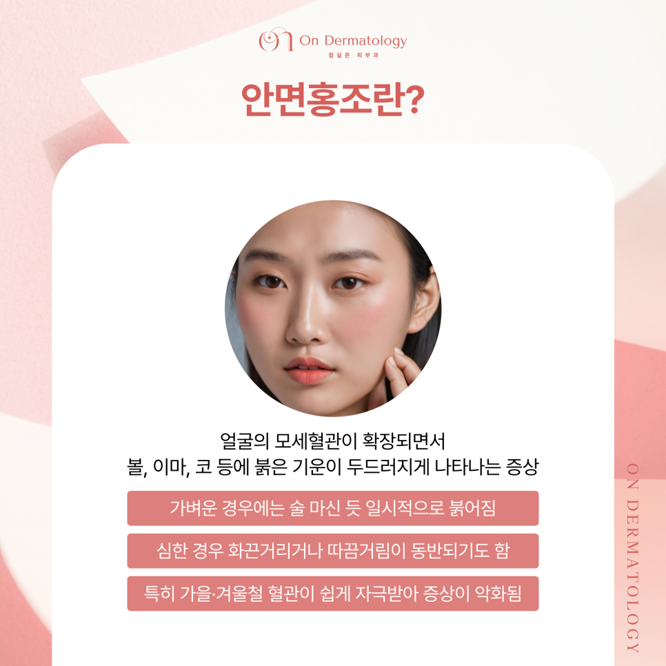가을에 심해지는 안면홍조와 주사, 잠실피부과 브이빔퍼펙타로 혈관 문제 개선하기 관련 이미지 2