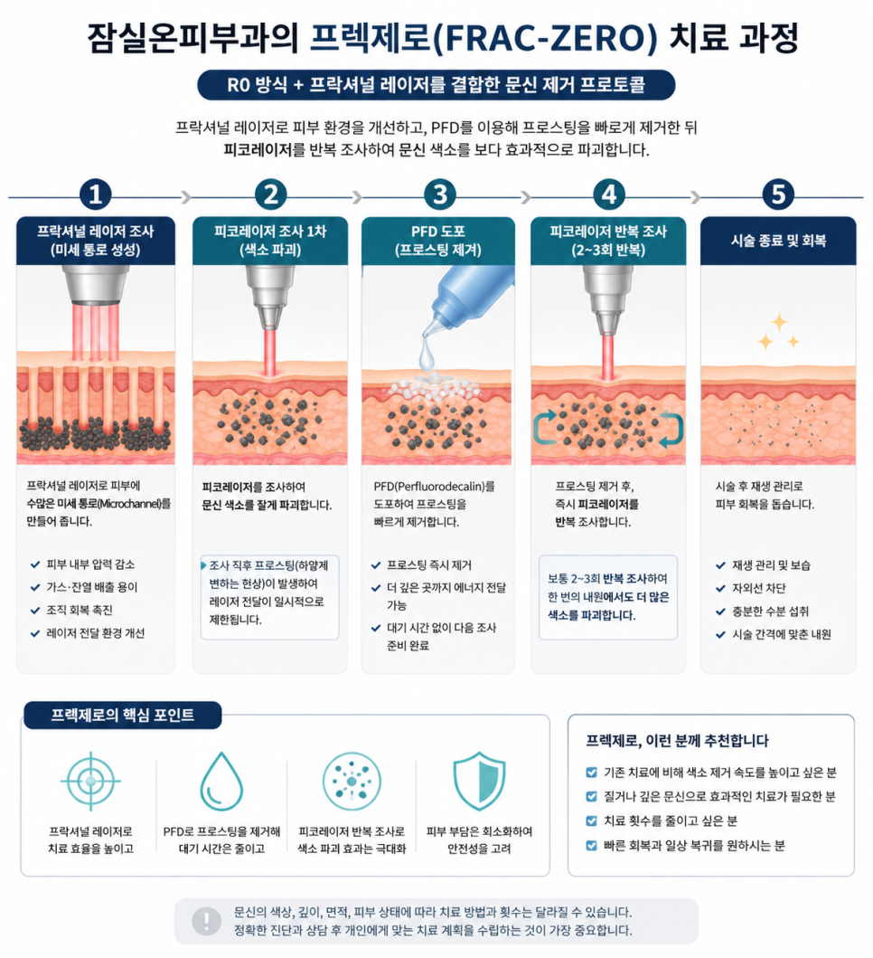 문신을 더 효율적으로 제거하는 방법 (2) 관련 이미지 4