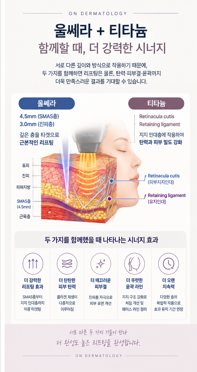 울쎄라 vs 티타늄, 리프팅 효과는 어떻게 다를까? 함께 받으면 더 좋을까? 관련 이미지 2