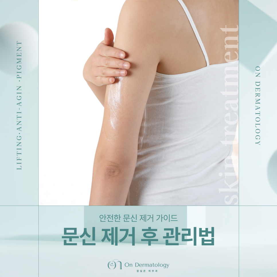 잠실 문신제거 피부과 피코레이저 문신 치료 후 관리는 이렇게 관련 이미지 1