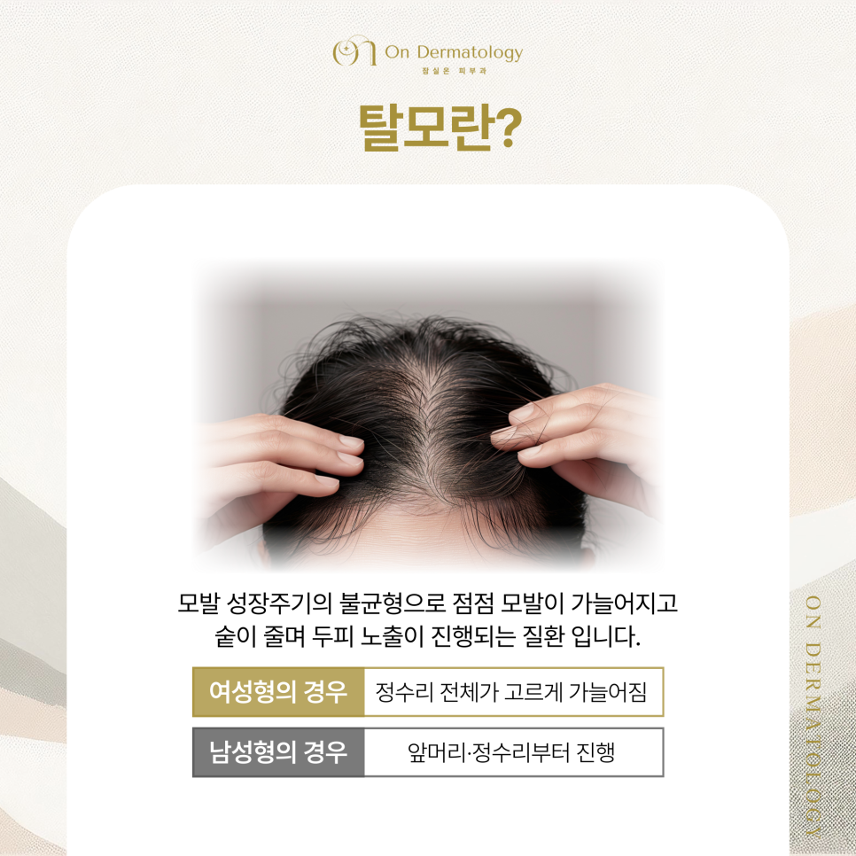 잠실역 탈모클리닉 치료를 위한 벨라룩스 라이트 & 탈모 모낭주사 장점은? 관련 이미지 2