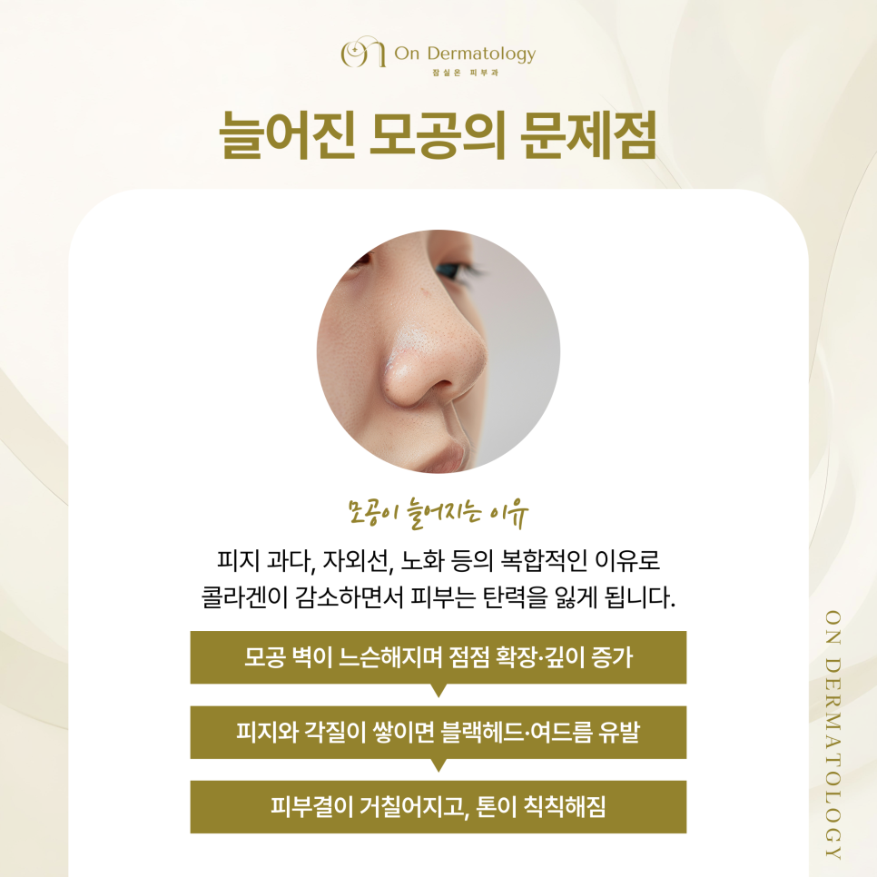 송파 피부과 늘어진 모공을 다시 좁히는 관리법(포텐자, 스킨보톡스, 쥬베룩) 관련 이미지 2