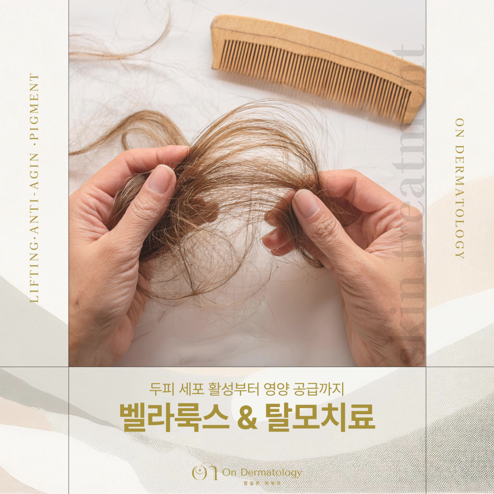 잠실역 탈모클리닉 치료를 위한 벨라룩스 라이트 & 탈모 모낭주사 장점은? 관련 이미지 1
