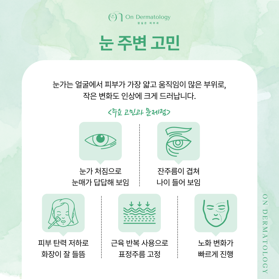 송파피부과 눈가 주름과 탄력 개선을 위한 리프팅 조합, 아이울써마지 포함 관련 이미지 2
