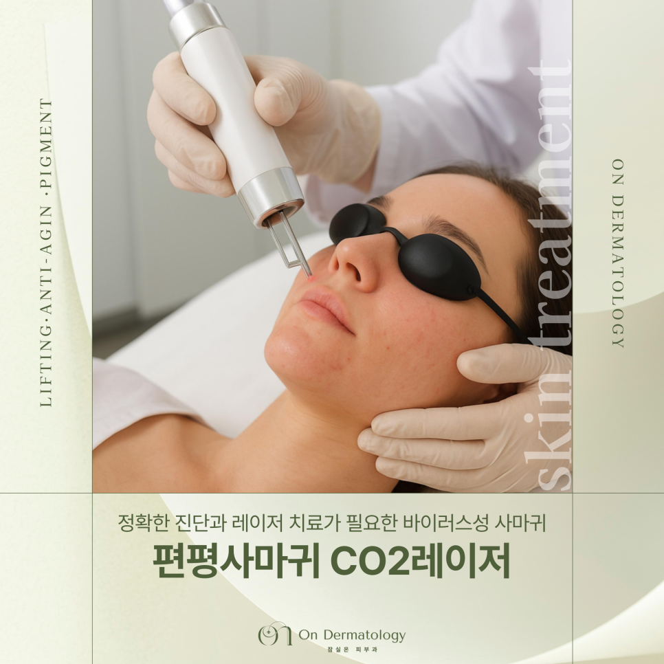 잠실역 피부과 전문의 편평사마귀 CO2레이저 제거 시 장점 및 방치하면 안되는 이유? 관련 이미지 1