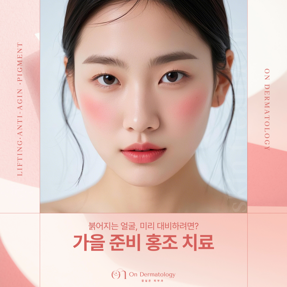 가을에 심해지는 안면홍조와 주사, 잠실피부과 브이빔퍼펙타로 혈관 문제 개선하기 관련 이미지 1