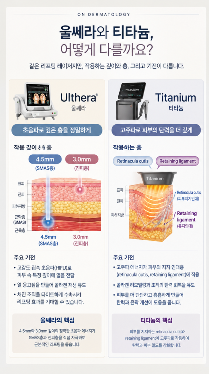 울쎄라 vs 티타늄, 리프팅 효과는 어떻게 다를까? 함께 받으면 더 좋을까? 관련 이미지 1