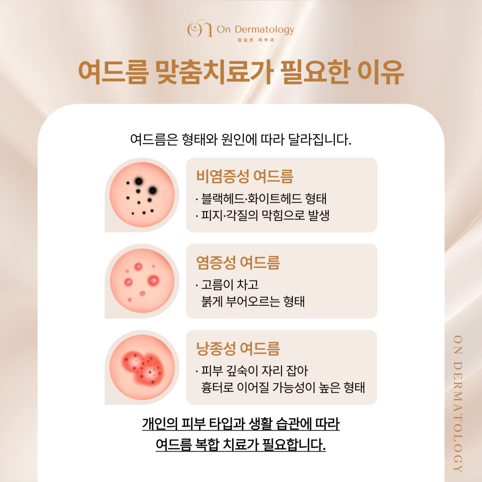 Songpa Dermatology Acne Customized Treatment, from Potenza Sebaceous Gland Destruction to Vbeam Perfecta image 2