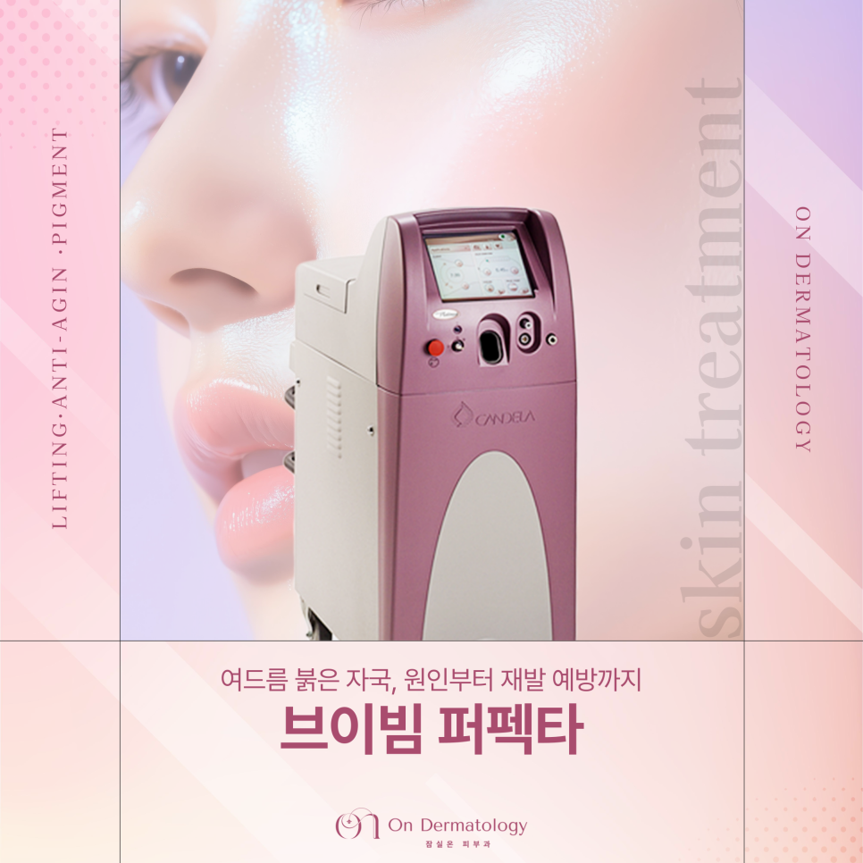 Shincheon-dong Dermatology: For Acne Red Marks, Vbeam Perfecta Treatment—What Are Its Advantages and Features? image 1