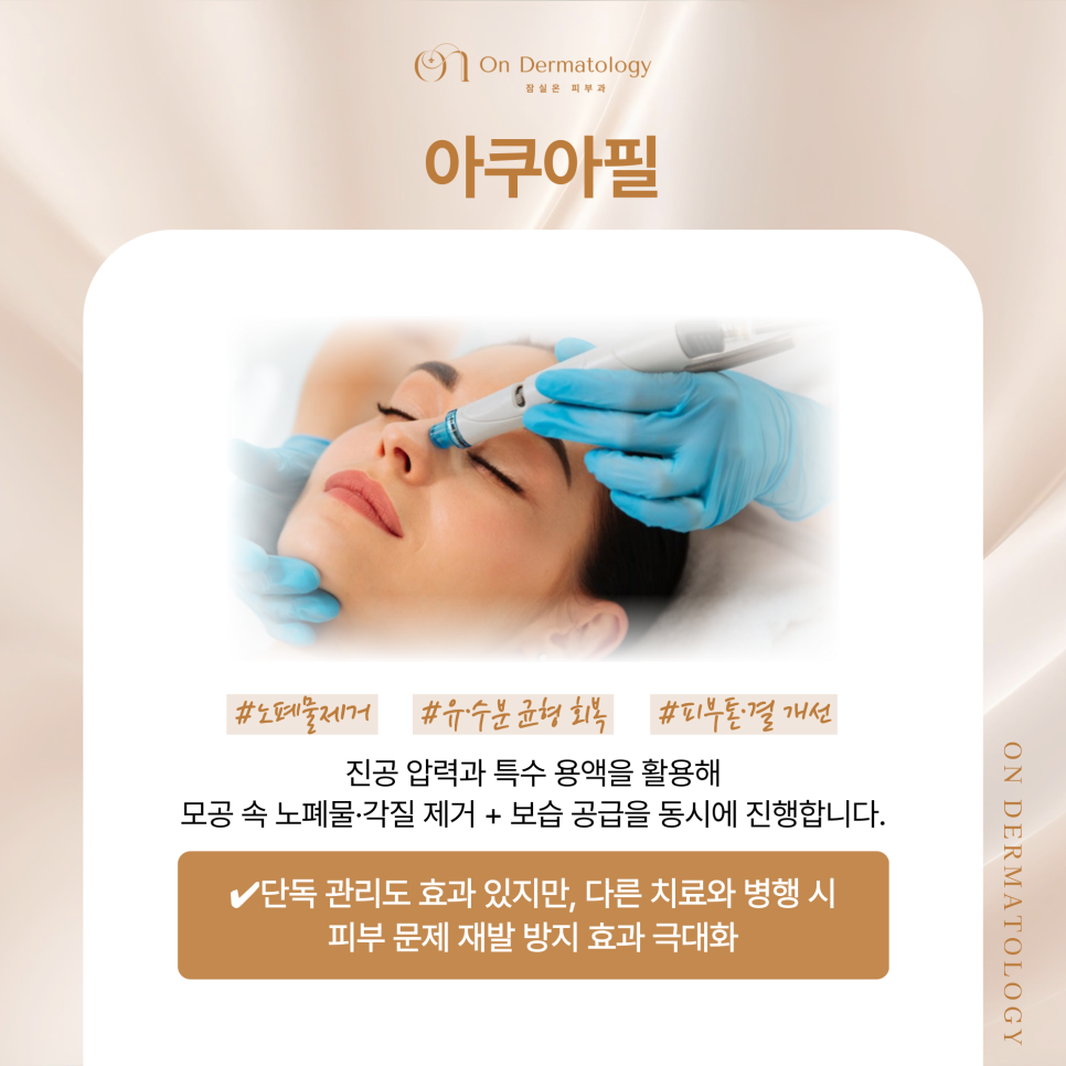 Songpa Dermatology Acne Customized Treatment, from Potenza Sebaceous Gland Destruction to Vbeam Perfecta image 6