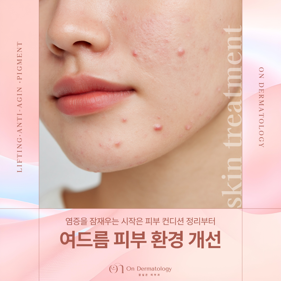 Improving Chronic Inflammatory Acne with Gold PTT and Peeling at a Jamsil Acne Dermatology Clinic image 1