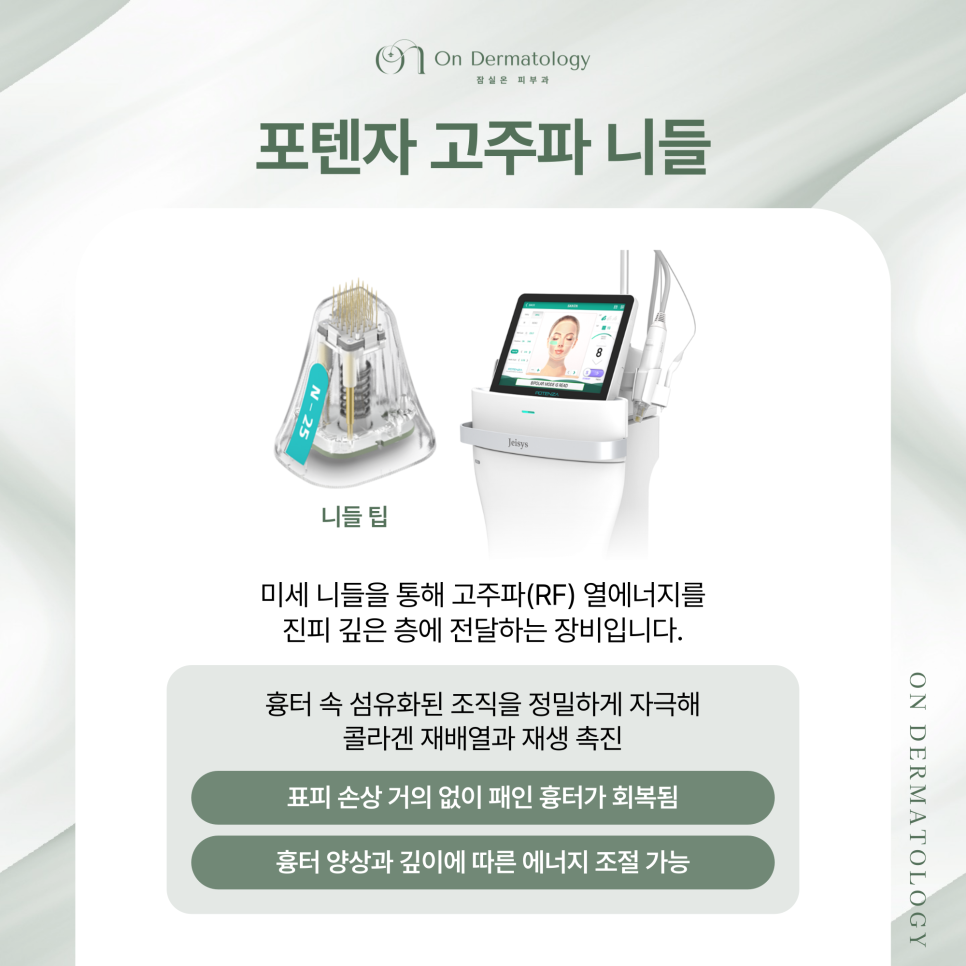 잠실피부과 피코MLA 및 서브시전 포함 흉터 복합 재생치료, 여러 치료 병행하는 이유? 관련 이미지 5
