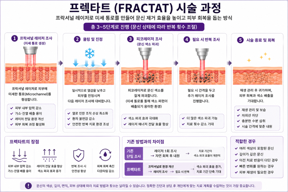 문신을 더 효율적으로 제거하는 방법 (2) 관련 이미지 3