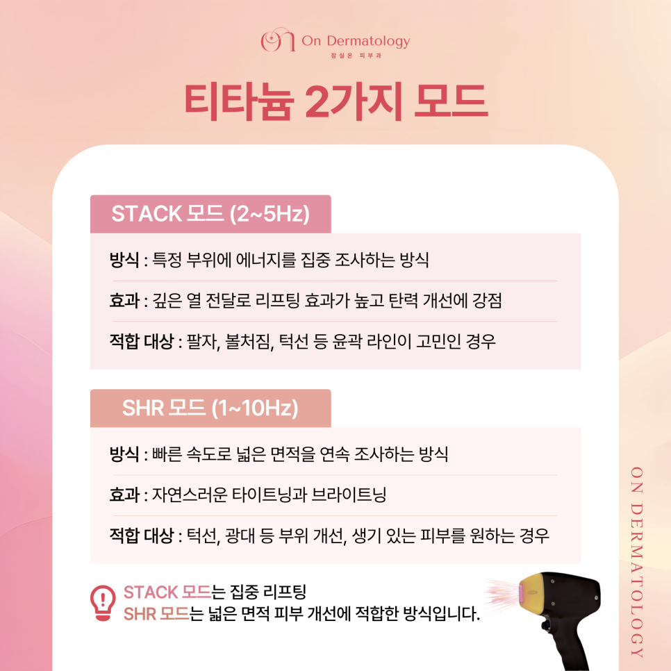 잠실피부과 얼굴 윤곽 처짐 개선을 위한 3가지 리프팅(울쎄라피 프라임, 티타늄 등) 관련 이미지 5