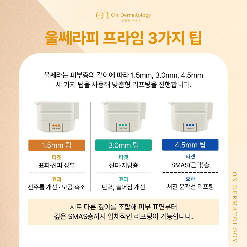잠실역 피부과 울쎄라피 프라임, 기존 울쎄라와 뭐가 다를까? 써마지FLX와의 차이? 관련 이미지 4