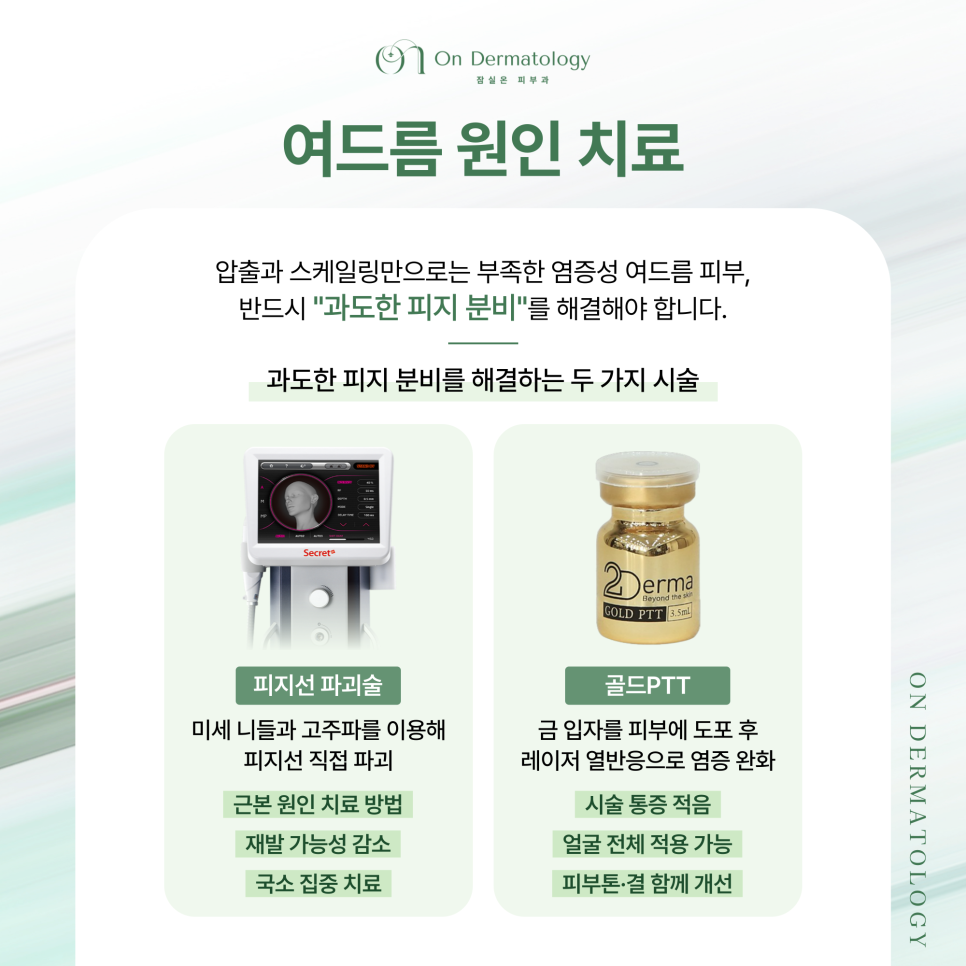 잠실역 피부과 전문의 여드름 압출과 스케일링, 그리고 여드름 원인치료까지 자세히 관련 이미지 6