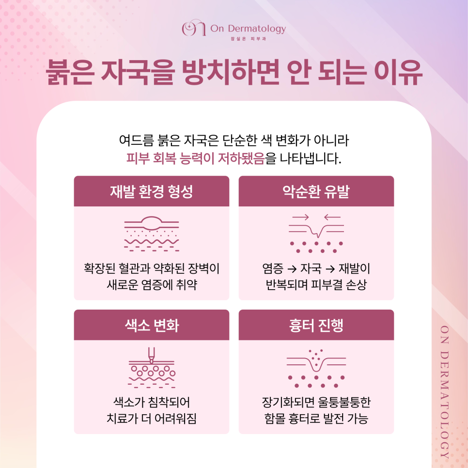 Shincheon-dong Dermatology: For Acne Red Marks, Vbeam Perfecta Treatment—What Are Its Advantages and Features? image 3