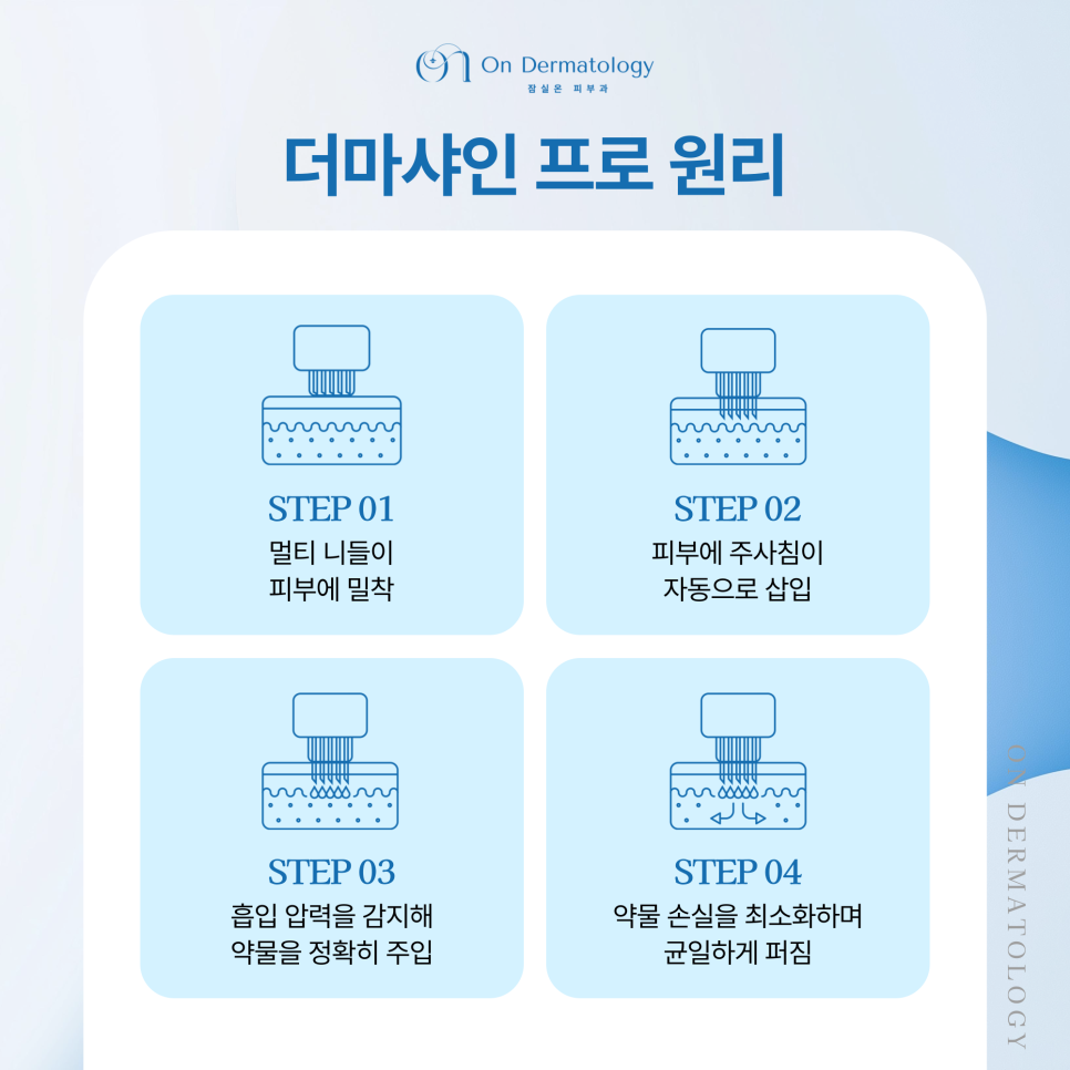 송파 피부과 콜라겐부스터 쥬베룩을 더욱 꼼꼼하게, 더마샤인 프로 인젝터 관련 이미지 5