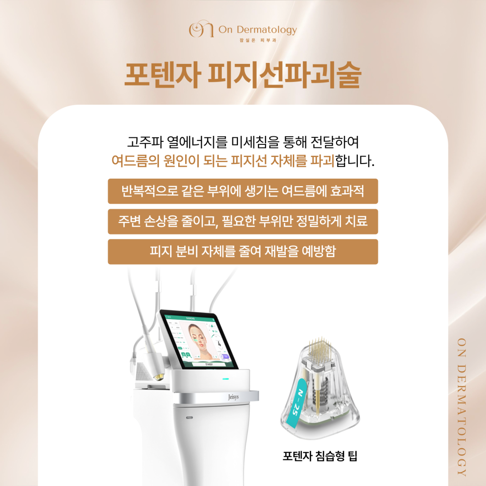 Songpa Dermatology Acne Customized Treatment, from Potenza Sebaceous Gland Destruction to Vbeam Perfecta image 3