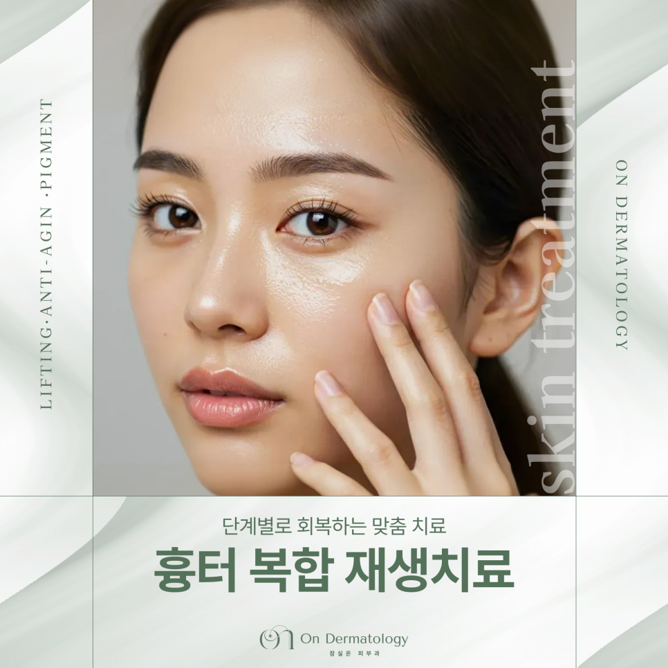 잠실피부과 피코MLA 및 서브시전 포함 흉터 복합 재생치료, 여러 치료 병행하는 이유? 관련 이미지 1