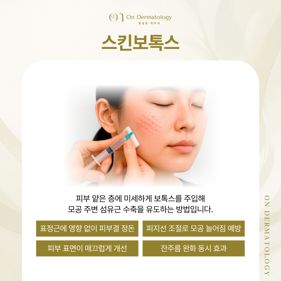 송파 피부과 늘어진 모공을 다시 좁히는 관리법(포텐자, 스킨보톡스, 쥬베룩) 관련 이미지 4