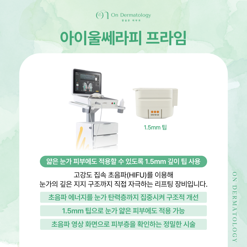 송파피부과 눈가 주름과 탄력 개선을 위한 리프팅 조합, 아이울써마지 포함 관련 이미지 4