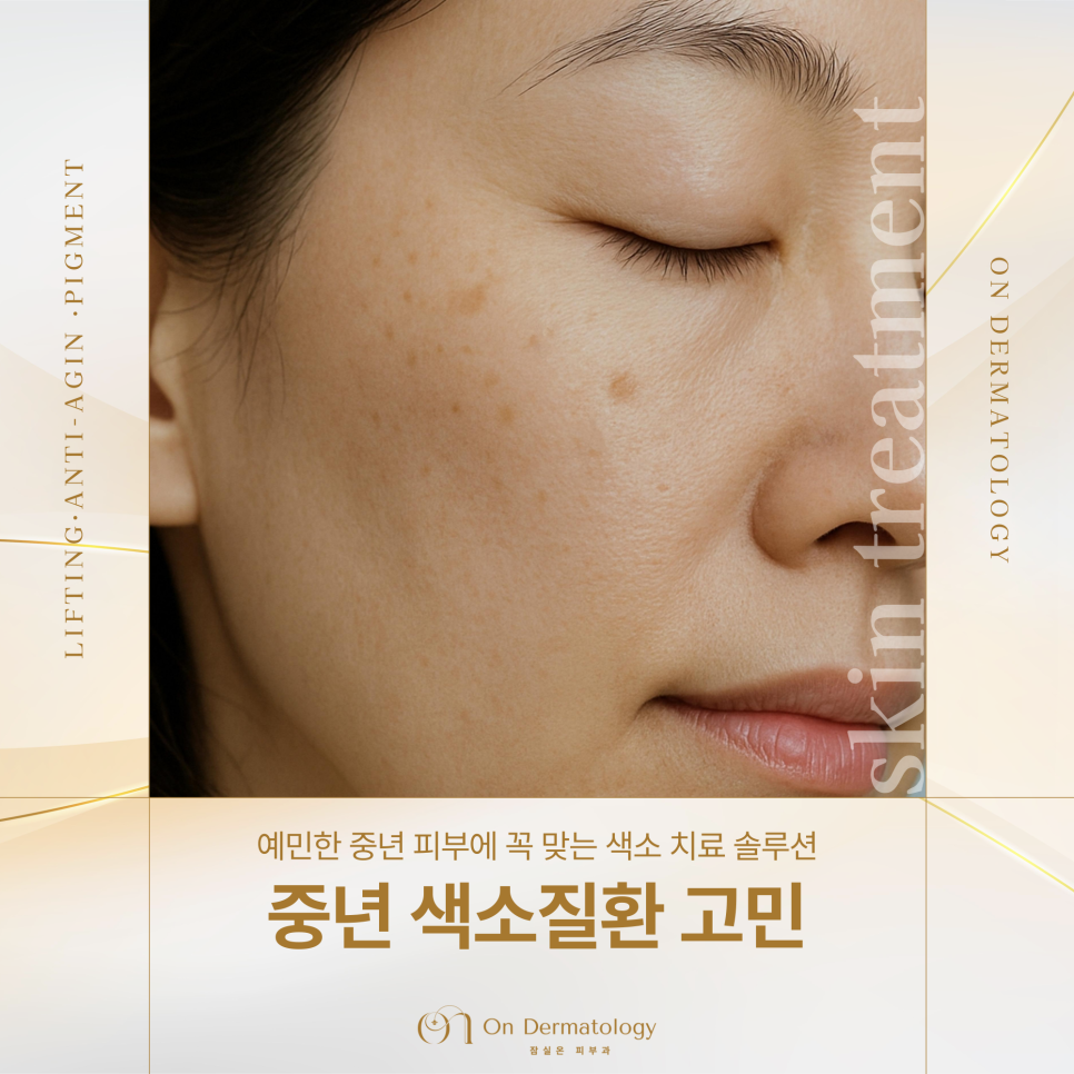 Jamsil Dermatology Clinic: Laser Pigment Treatment for Middle-Aged Concerns Such as Melasma and Age Spots image 1