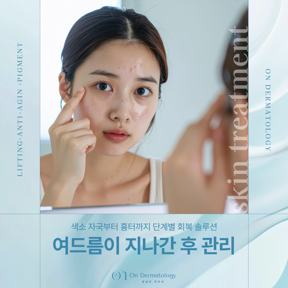 Jamsil Station Dermatology: Treating Post-Acne Hyperpigmentation and Scars Like This! image 1