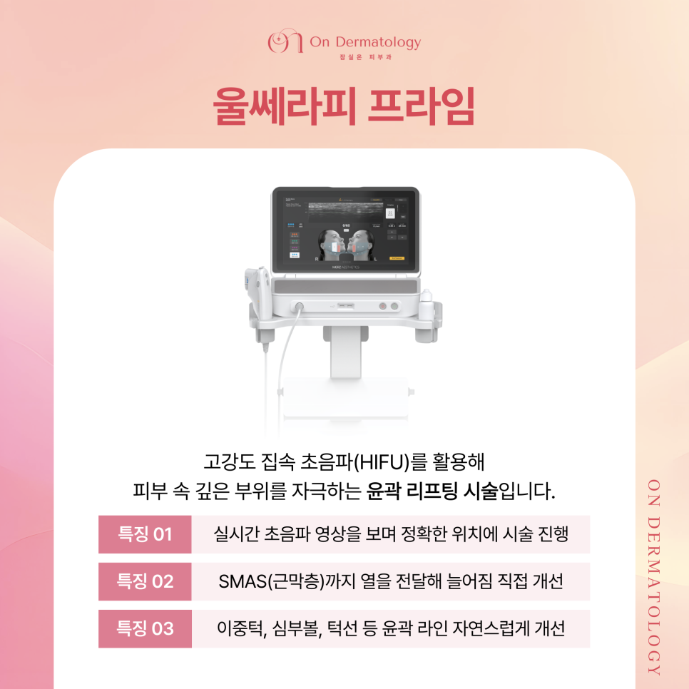 잠실피부과 얼굴 윤곽 처짐 개선을 위한 3가지 리프팅(울쎄라피 프라임, 티타늄 등) 관련 이미지 2