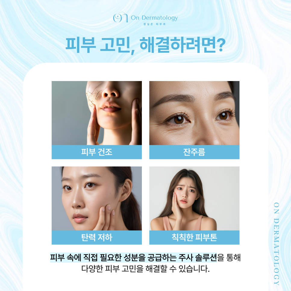 간편하면서도 효과적인, 잠실역 피부과 주사를 이용한 피부 개선(리바이브, 쥬베룩 등) 관련 이미지 2