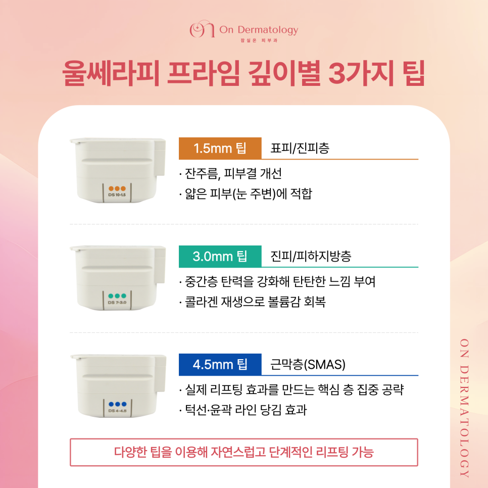 잠실피부과 얼굴 윤곽 처짐 개선을 위한 3가지 리프팅(울쎄라피 프라임, 티타늄 등) 관련 이미지 3