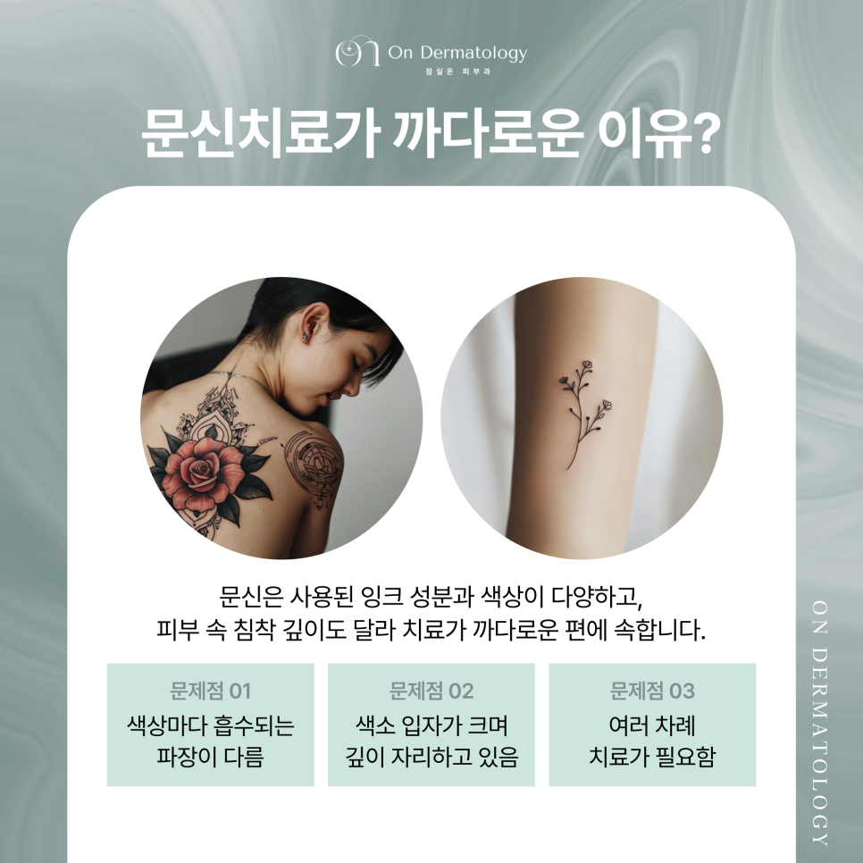 To See Proper Results from Pigmentation and Tattoo Treatment at Jamsil Station Dermatology, What Matters? image 5