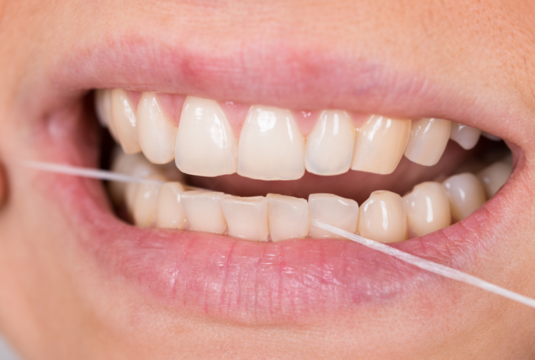 Could I Have Bad Breath? A 1-Minute Self-Check in Front of the Mirror image 3