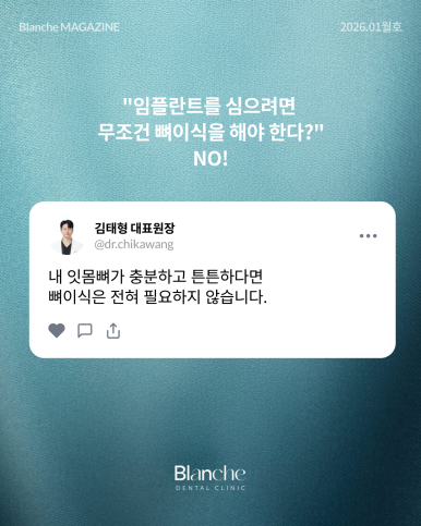 "임플란트 뼈이식, 무조건 해야 하나요?" 과잉진료 피하는 법 관련 이미지 4