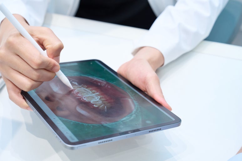 무삭제라미네이트 부작용부터 확인해야 해요 관련 이미지 5