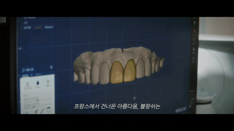 우주소녀 다영이 선택한 블랑쉬, 연예인들이 블랑쉬만 고집하는 이유 관련 이미지 9