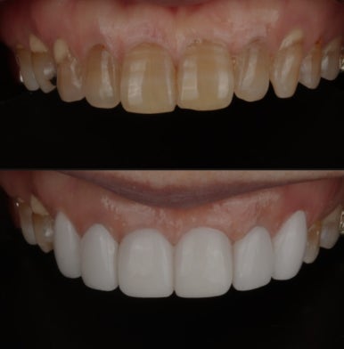 무삭제라미네이트 가격, 어떤 점을 알아보면 좋을까요? 관련 이미지 3