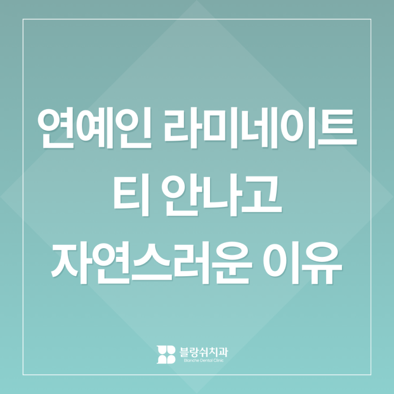 연예인 라미네이트 티 안나고 자연스러운 이유 관련 이미지 10