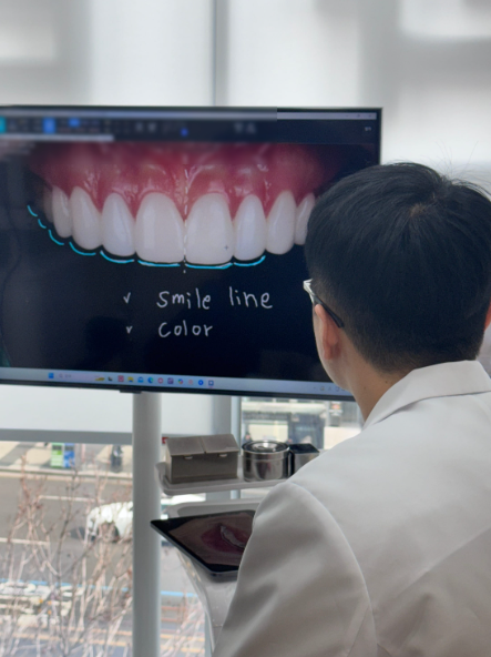 At-Home Teeth Whitening vs. Professional Dental Whitening: Which Should You Choose? image 5