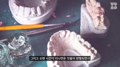 노인틀니 vs 디지털풀아치, 부모님 씹는 힘 2배 높이는 선택 기준 관련 이미지 2