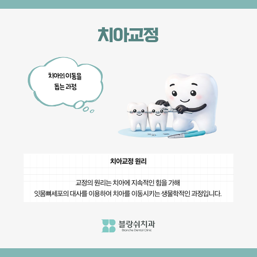 압구정치과 치아교정이 고민이라면 필독 관련 이미지 2