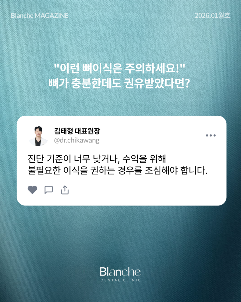 "임플란트 뼈이식, 무조건 해야 하나요?" 과잉진료 피하는 법 관련 이미지 10