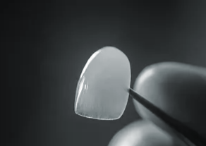 Can No-Prep Veneers Really Be Done at a Seocho Dental Clinic? Misconceptions and Facts image 5