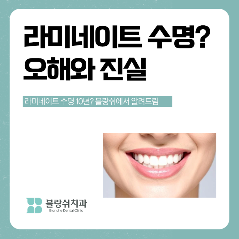 라미네이트 수명 10년? 오해와 진실 관련 이미지 1