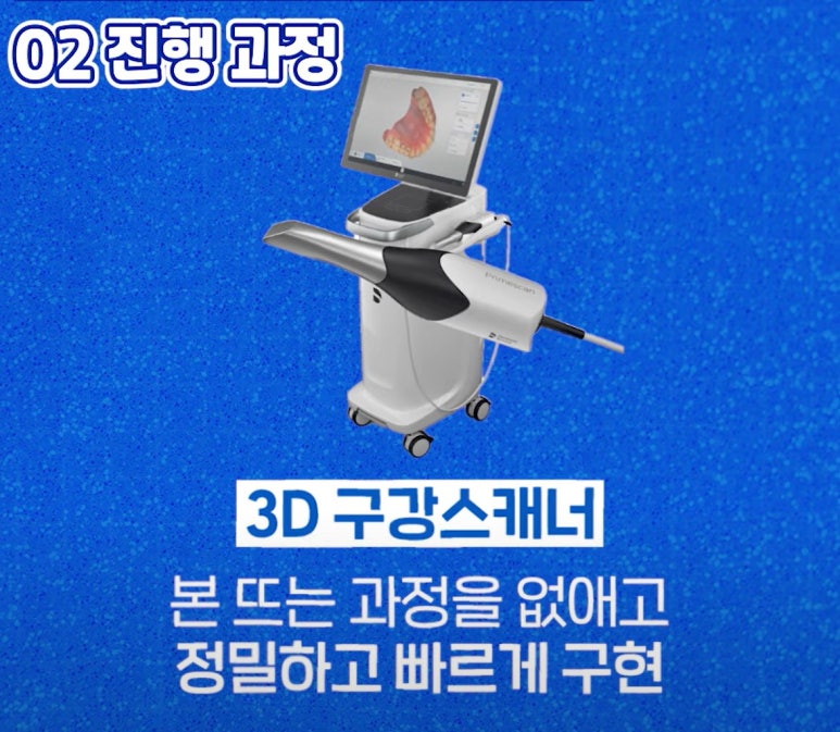 풀아치 임플란트 치과? 임플란트 결정 전 꼭 읽어보세요. 관련 이미지 7