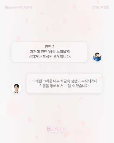 잇몸이 까맣게 변했어요! 원인별 맞춤 해결법 관련 이미지 7