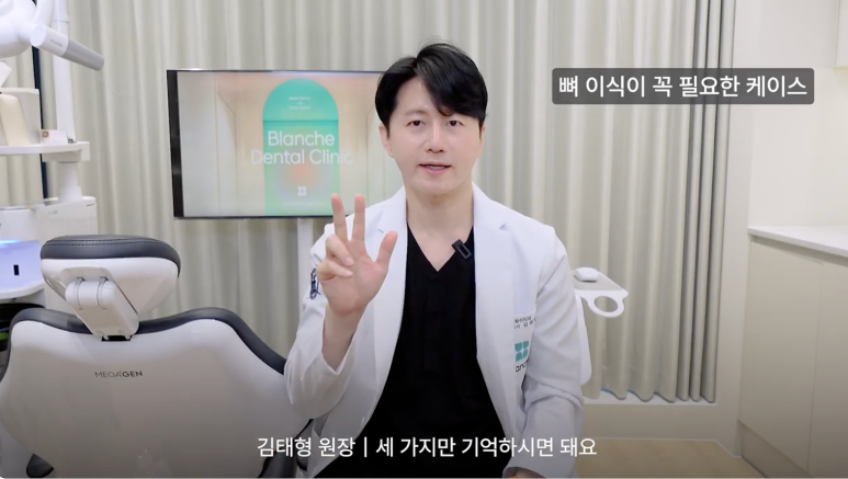 어금니 임플란트 뼈이식 통증 비용 총정리 관련 이미지 1